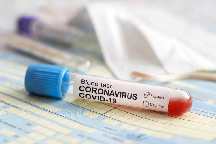 Comenzó la aplicación de la segunda dosis de vacunación contra el Coronavirus